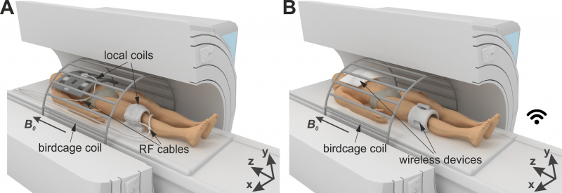 A – Standard procedure of clinical MRI; B – Proposed approach. The illustration is from the article.